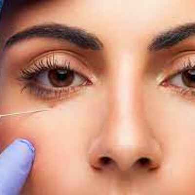 Mezoterapia igłowa okolice oczu